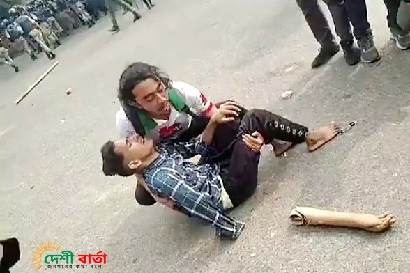 ‘আমার একটা হাত নাই, আর্টিফিশিয়াল হাত, এটাও ওরা বাড়ি মেরে ভেঙে ফেলছে’